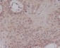 Anti-ER alpha ESR1 Rabbit Monoclonal Antibody